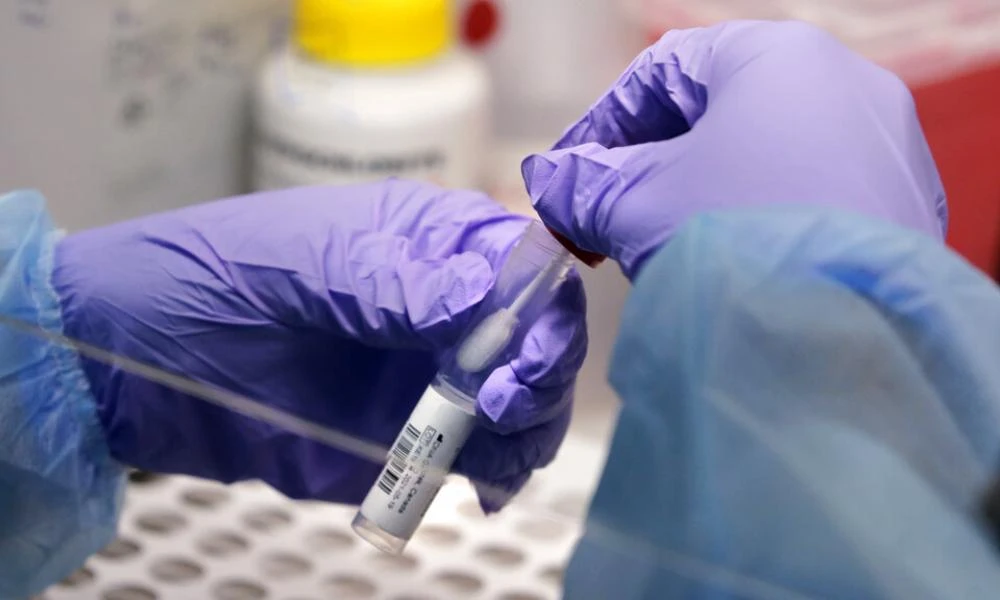 Σε ποια σημεία γίνονται δωρεάν rapid test την Τετάρτη 3 Απριλίου